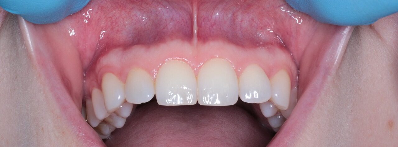 mouth