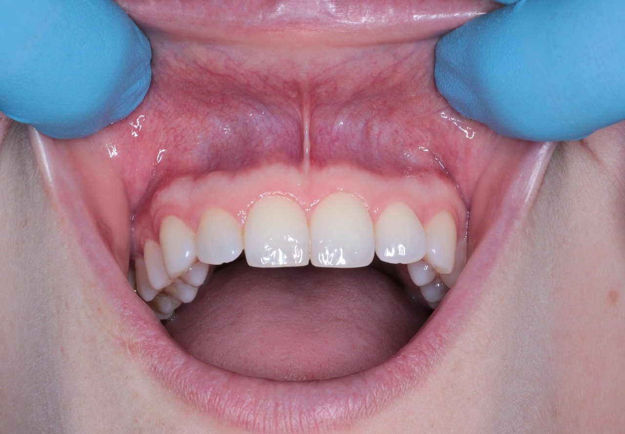 mouth